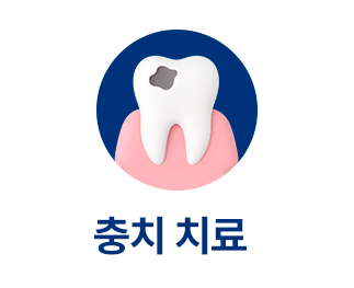 진료과목-충치치료