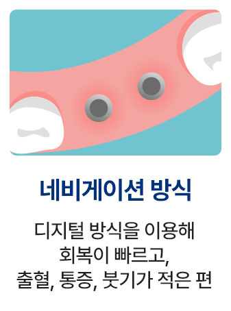 네비게이션 방식